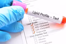 Mỡ máu cao bao nhiêu là dấu hiệu đáng báo động?