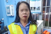 Vấn đề pháp lý vụ nhân viên gác tàu bị đánh gãy xương mũi