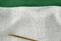 Người phụ nữ thủng ruột non do... tăm tre