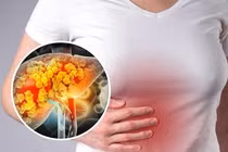 5 loại lá thảo dược là “khắc tinh” của gan nhiễm mỡ