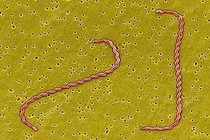 Sốt, đau đầu tưởng “ốm xoàng”, đi khám phát hiện vi khuẩn gây viêm màng não 