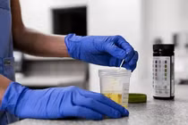 Màu sắc nước tiểu báo hiệu điều gì về sức khoẻ?