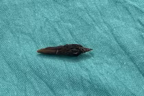 Ăn yến chưng nuốt luôn hạt táo đỏ, người phụ nữ bị thủng ruột