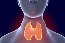 Trẻ nhỏ đã bị cường giáp Basedow, người lớn chớ chủ quan