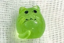 Gắp dị vật đồ chơi "túi mù" trong cơ thể bé gái 6 tuổi