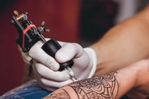 Cảnh báo tai biến thẩm mỹ sau xăm mình