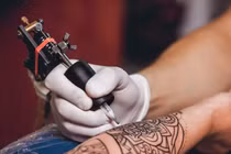 Cảnh báo tai biến thẩm mỹ sau xăm mình