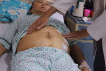 Đặt lưới nhân tạo cho bà cụ 79 tuổi