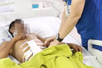 Bỏ qua mọi thủ tục cứu người bị thanh sắt đâm xuyên từ lưng ra bụng