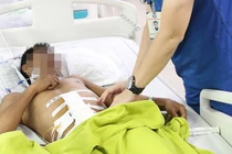 Bỏ qua mọi thủ tục cứu người bị thanh sắt đâm xuyên từ lưng ra bụng