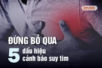 Đừng bỏ qua 5 dấu hiệu cảnh báo suy tim