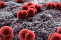 Hơn 10% dân số có thể mang vi khuẩn não mô cầu