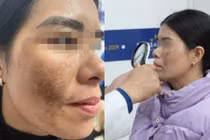 Vội vàng làm đẹp đón Tết - coi chừng "tiền mất - tật mang"