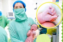 Hy hữu: Bé trai chào đời cùng với vòng tránh thai của mẹ