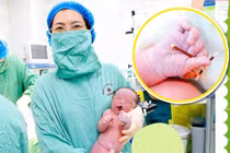 Hy hữu: Bé trai chào đời cùng với vòng tránh thai của mẹ