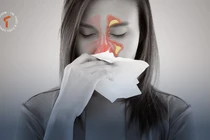 [LONGFORM]: Khổ sở vì viêm xoang mùa lạnh… bác sĩ mách bí kíp phòng ngừa