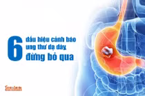 6 dấu hiệu cảnh báo ung thư dạ dày, đừng bỏ qua
