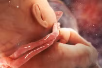 Cận cảnh em bé chào đời với 3 vòng hoa quấn cổ: Cẩn thận biến chứng