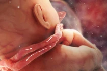 Cận cảnh em bé chào đời với 3 vòng hoa quấn cổ: Cẩn thận biến chứng