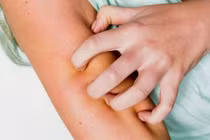 7 dấu hiệu trên da cảnh báo gan đang dần mất chức năng