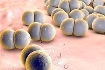 Bé trai 12 tuổi mắc bệnh do não mô cầu, cách phòng bệnh hiệu quả