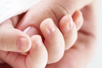 Kỳ tích 1 năm "cứu" bé sinh non 24 tuần tuổi, nhiều bệnh nguy kịch