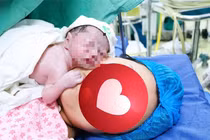 Cứu thai nhi thiểu ối, chậm tăng trưởng 26 tuần tuổi bằng truyền ối