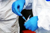 Dịch bệnh "bí ẩn" ở Congo khiến nhiều người tử vong: Triệu chứng bệnh thế nào? 