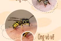 Nhiều trẻ nguy kịch vì ong đốt: Bác sĩ mách cách xử trí và phòng tránh