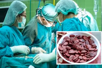 Ăn hạt dưa không nhả vỏ, thiếu nữ khiến bác sĩ sợ tái mặt vì...