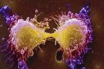 Kinh ngạc cách tế bào ung thư chống lại hóa trị