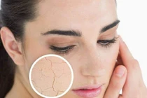 Bí kíp phục hồi da lão hóa cho khuôn mặt trẻ trung, xinh đẹp