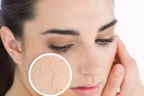 Bí kíp phục hồi da lão hóa cho khuôn mặt trẻ trung, xinh đẹp