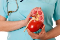 Hy vọng mới cho bệnh nhân suy thận mạn