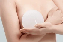 Ngực chảy dịch suốt nửa năm sau cấy mỡ tự thân