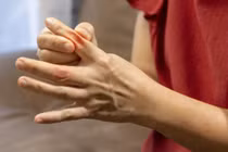 Sưng các khớp ngón tay, phát ban vùng mặt... đi khám mắc bệnh nguy hiểm