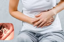 Dấu hiệu "âm thầm" cảnh báo cơ thể đang chứa đầy giun, cần tẩy gấp