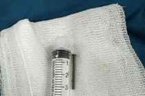 Bé trai 6 tuổi nuốt phải đinh sắt dài 3 cm trong lúc chơi đùa