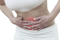 Phát hiện ung thư cổ tử cung từ biểu hiện rối loạn kinh nguyệt 