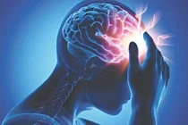 Thói quen "vô tình" làm tăng nguy cơ đột quỵ ở người trẻ