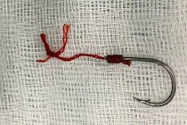 Dị vật móc câu cá cắm sâu vào hậu môn người đàn ông 40 tuổi