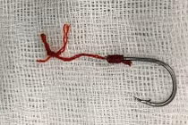 Dị vật móc câu cá cắm sâu vào hậu môn người đàn ông 40 tuổi