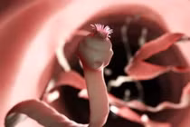 Thói quen ăn uống “mở đường” cho sán vào người, ít ai để ý