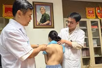 Trẻ bị biến chứng nặng nề do vẹo cột sống