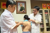 Trẻ bị biến chứng nặng nề do vẹo cột sống