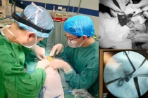 Phẫu thuật thành công cho bé gái 1 tháng tuổi bị teo mật bẩm sinh