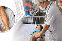 Cẩn trọng với bệnh viêm mao mạch dị ứng ở trẻ em