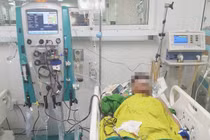 "Trào lưu" lọc máu ngừa đột quỵ, tim mạch nguy hiểm như nào?