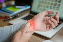 Dấu hiệu cảnh báo hội chứng ống cổ tay, dân văn phòng không nên bỏ qua