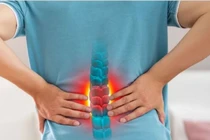 Suýt bị liệt vì... bê bao xi măng nặng 50 kg